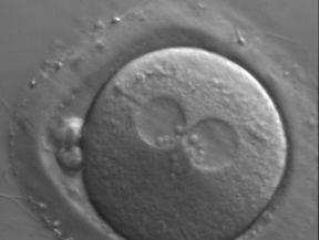 Zona pellucida surrounding a single cell embryo