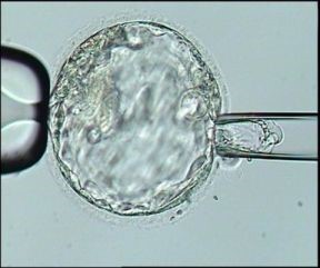 Embryo biopsy procedure. 