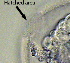 Blastocyst with Assisted Hatching